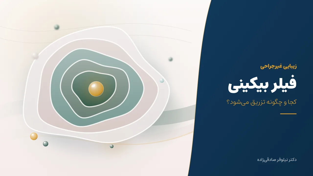     فیلر بیکینی چیست و کجا تزریق می‌شود؟ بررسی محل تزریق فیلر لابیا ماژور